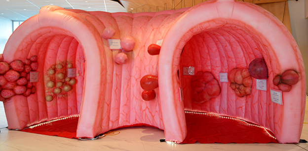 Jumbo Colon